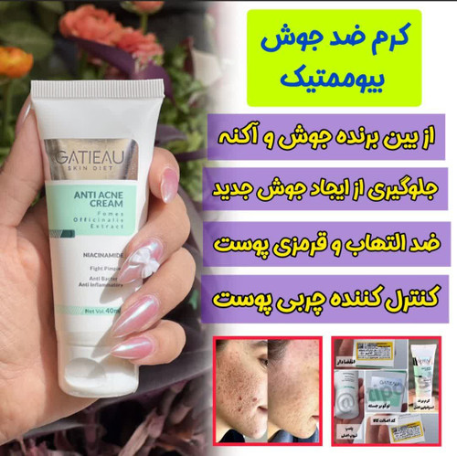 قویترین کرم ضد جوش و لک برند گاتیو ایتالیا اورجینال